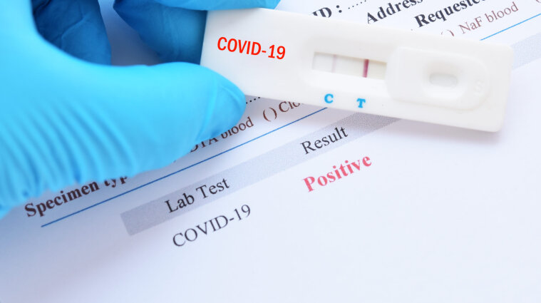 Учені повідомили, коли є найбільша вірогідність заразитися від хворого на COVID-19