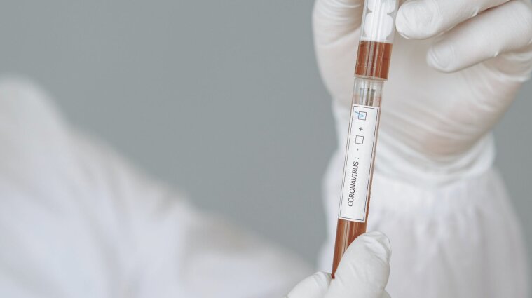 В Італії продають підробні тести на коронавірус
