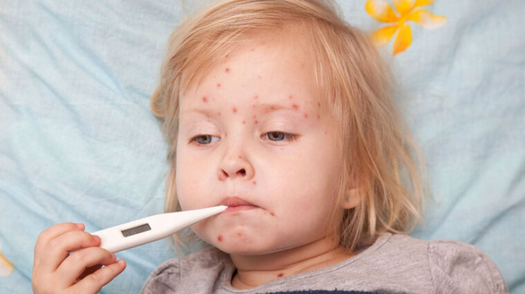 В Украине стартует общенациональная кампания по вакцинации детей против кори - Кузин