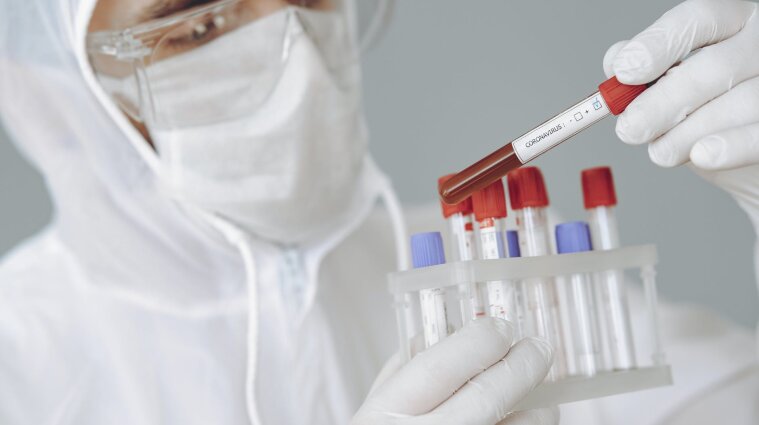 Українські та ізраїльські вчені спільно розроблятимуть вакцину від коронавірусу