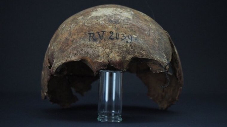 Чума існувала і п'ять тисяч років тому: у кістках мисливця знайшли найдавніший штам