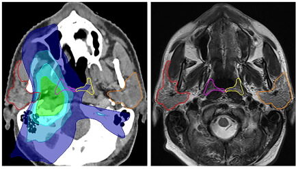 В человеческой памяти открыли новый орган: какая связь с раком