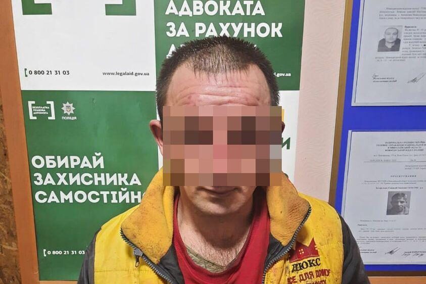 В Николаеве мужчина вылил на жену и двоих детей неизвестное химвещество