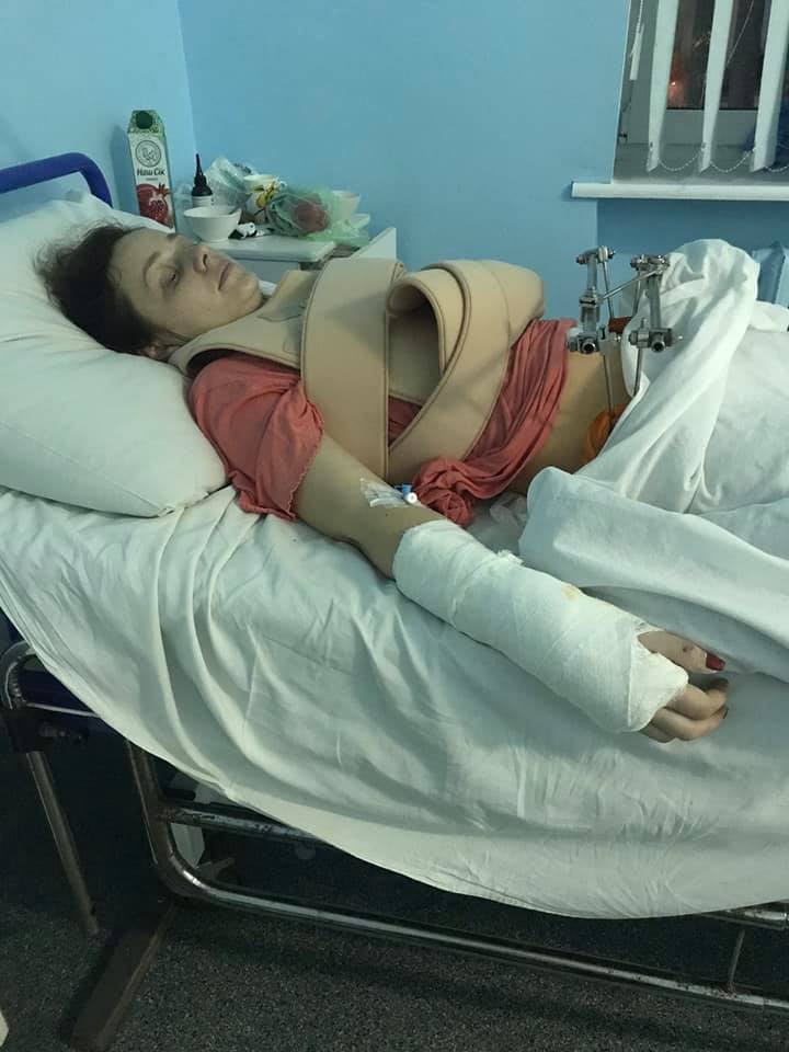 Стало известно о состоянии пострадавшей в ДТП на остановке в Киеве