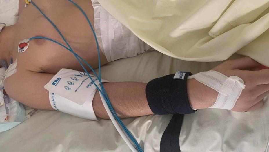 У Парижі жорстоко побили підлітка: пробитий череп, переламані руки