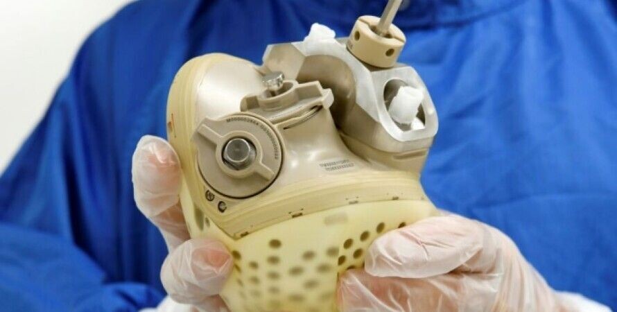 У США людині вперше імплантували повністю штучне серце