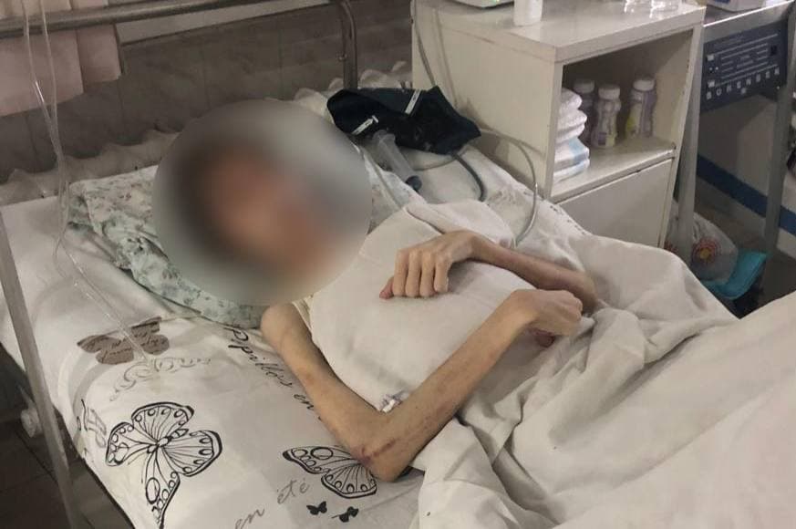 В Одесі батько морив голодом свого сина