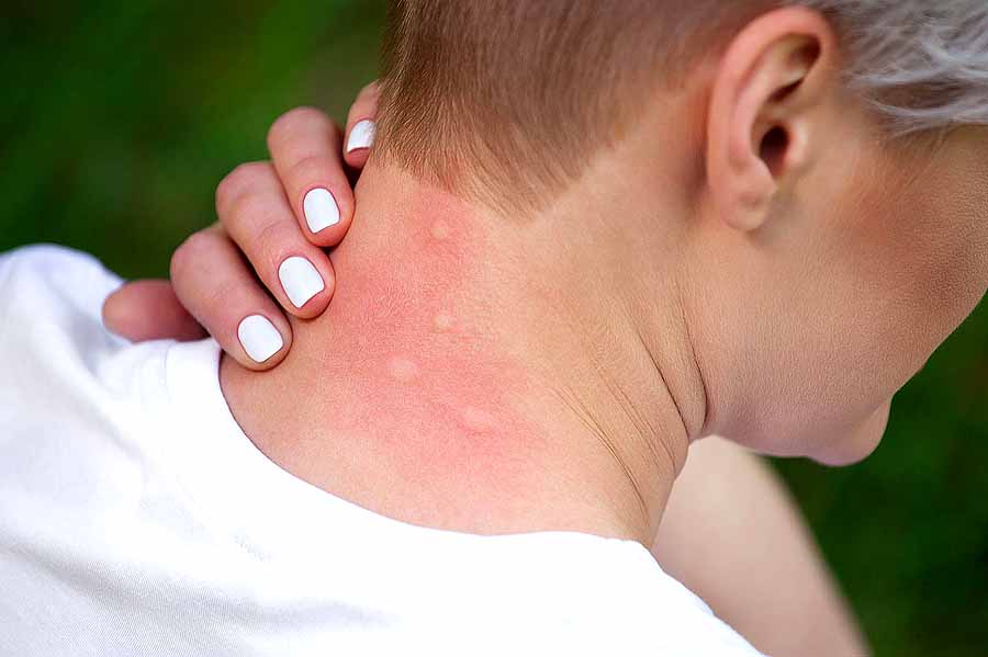 Почти десятисантиметрового гельминта вытащили из головы женщины в Ровенской области