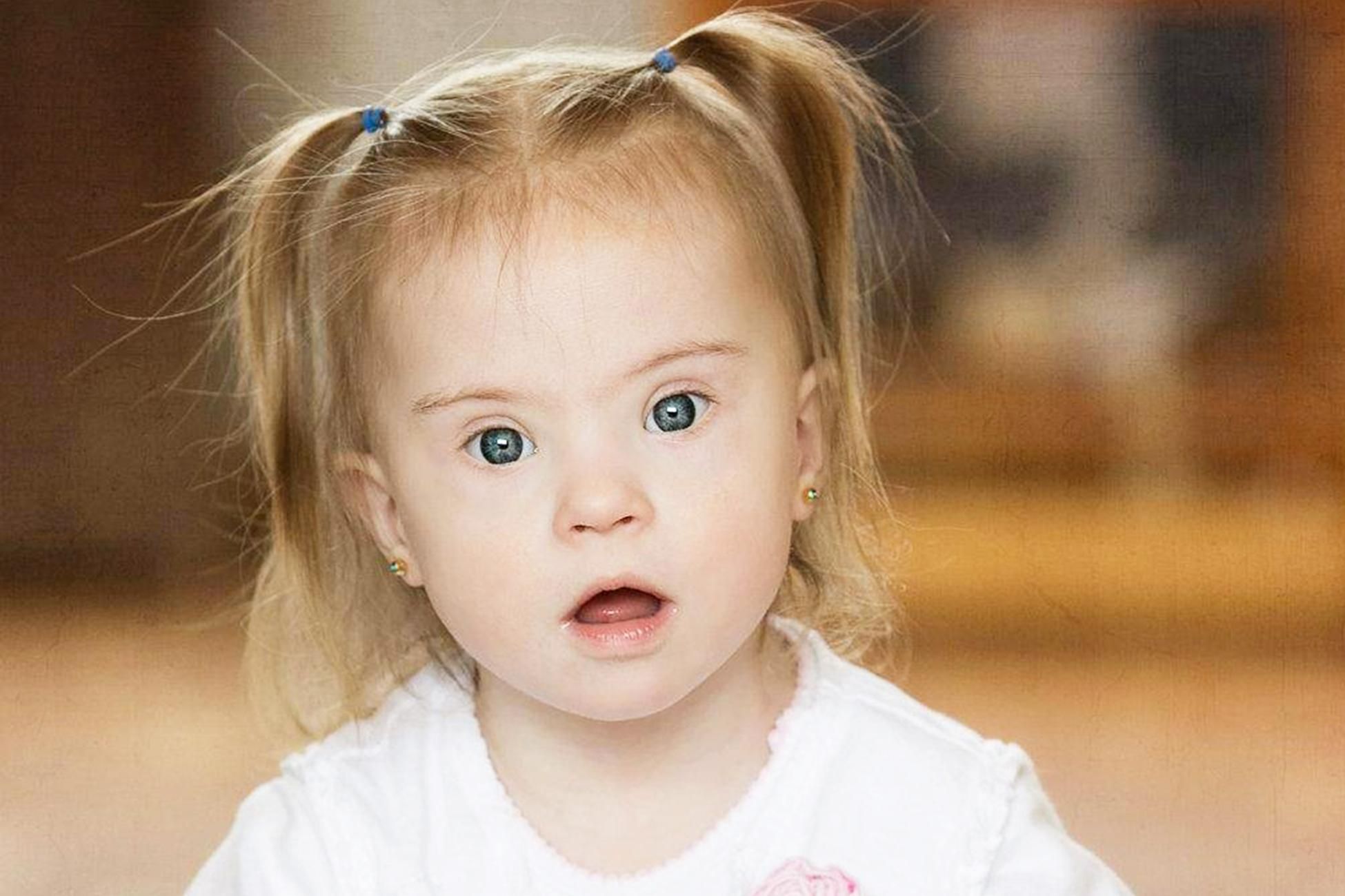 Синдром Дауна: правда і міфи про "сонячних" людей