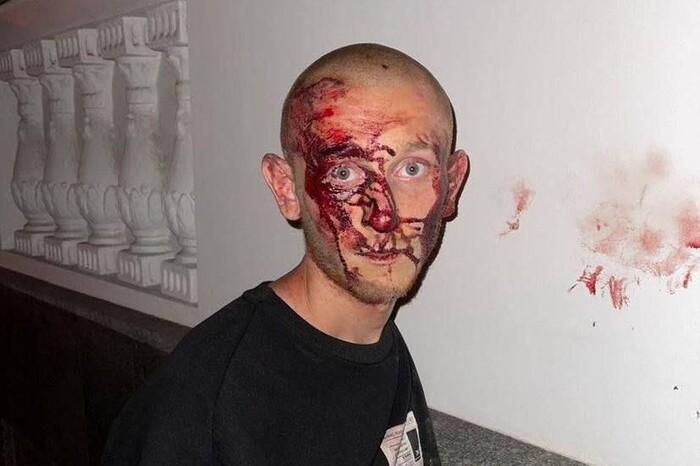 На Полтавщині затримали фітнес-тренера, який плюнув у військового