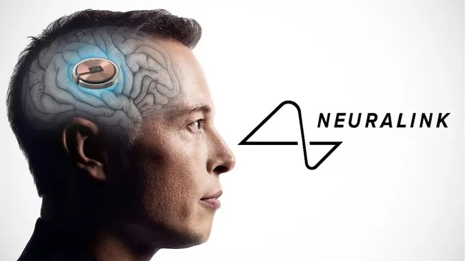 Чіпи Neuralink замість смартфонів у майбутньому: що придумав Ілон Маск