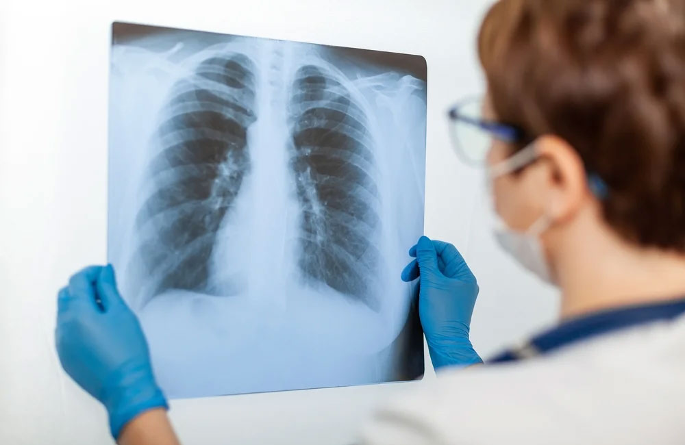 Пневмония: причины появления, основные симптомы и лечение