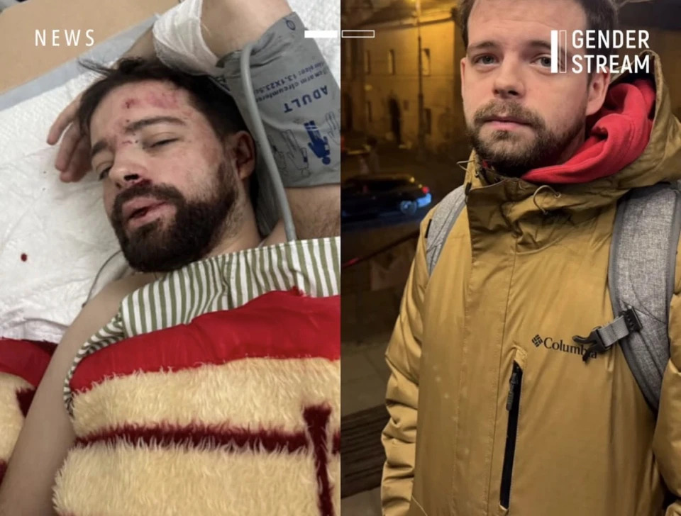 Під Києвом на узбіччі з проламаним черепом знайшли викладача львівського університету Франка Степана Більченка