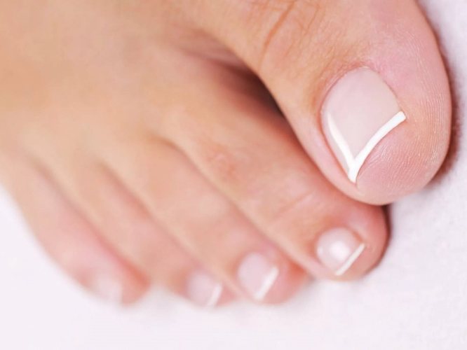 Гнойник вокруг ногтя: чем лечить и опасны ли паронихии