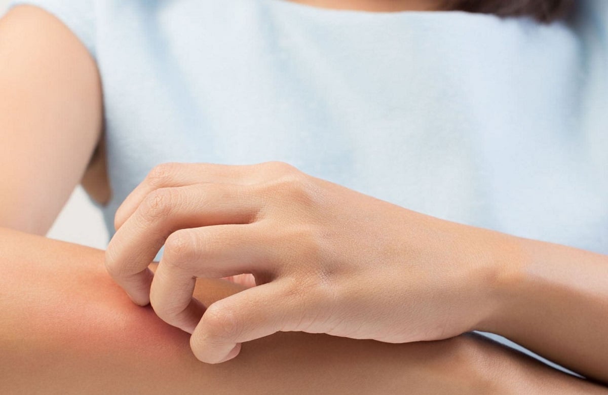 Зуд кожи может указывать на проблемы с почками: что нужно знать