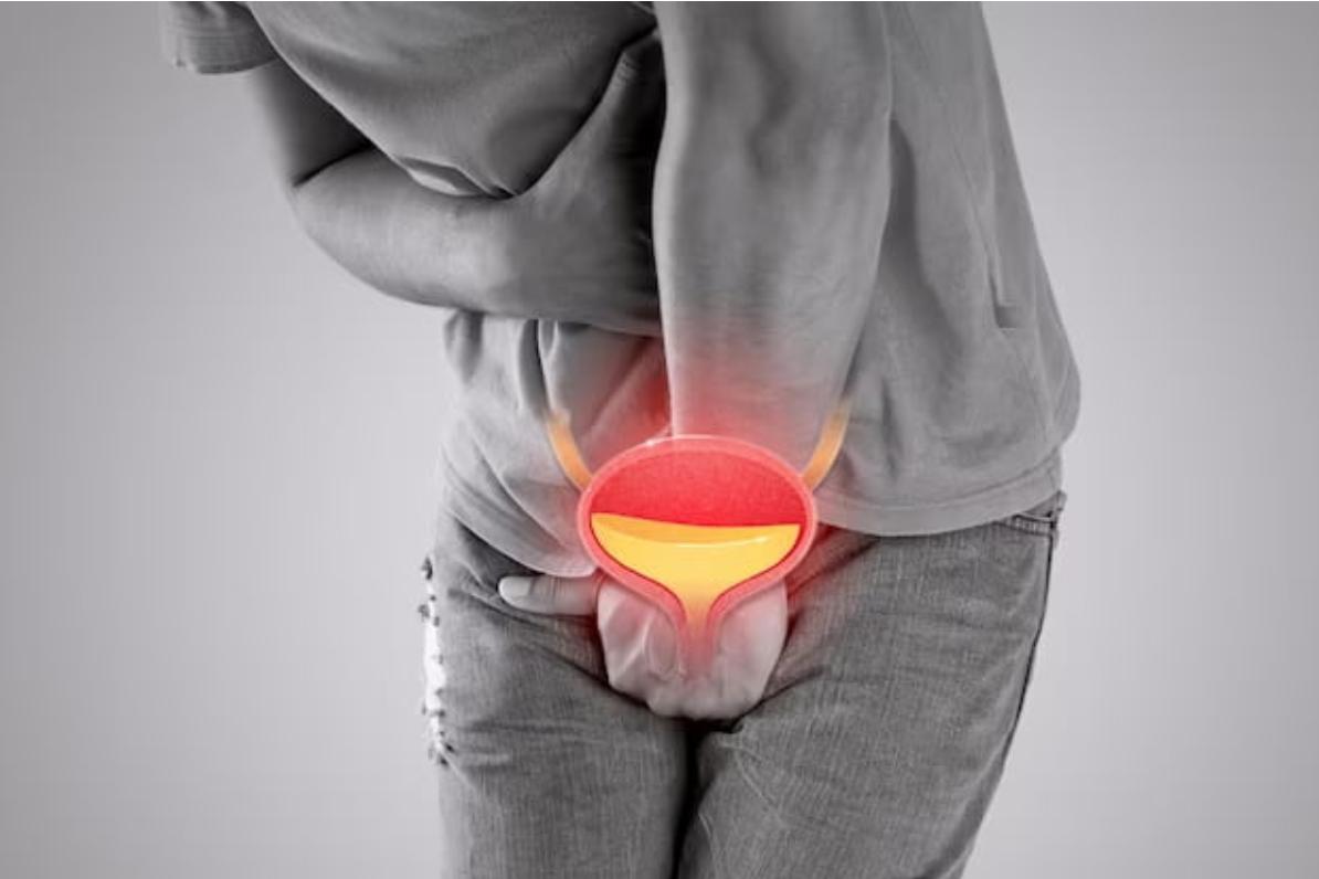 Крок до полегшення: як лікувати гострі неускладнені інфекції нижніх сечовивідних шляхів