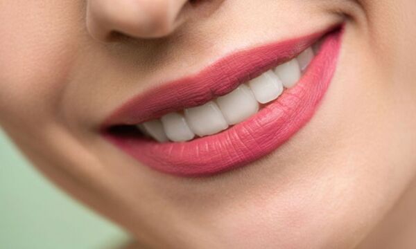 Як зберегти зуби здоровими під час свят: проста порада стоматолога, яка врятує вашу емаль