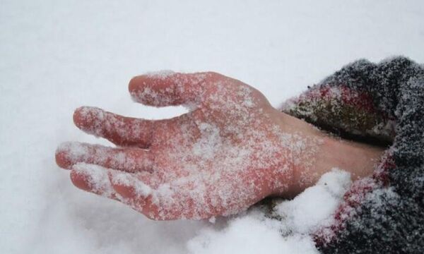 В январе 2026 года из-за мороза госпитализировали почти 1500 украинцев